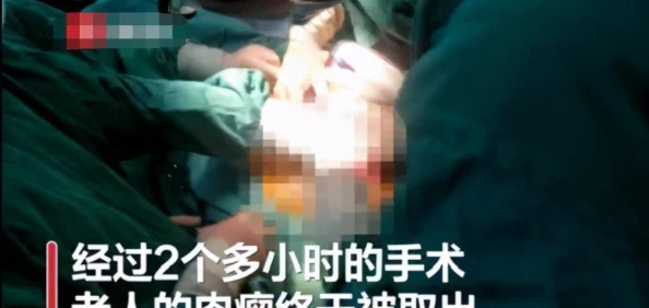 肚子里灌满浓浆曝光视频引热议画面令人不适建议谨慎观看