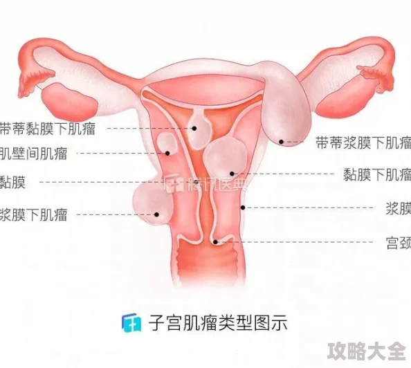 睾丸进入子宫的里面长肉粒正常吗该描述指向医学谬误需咨询医生勿信网络信息