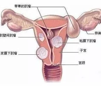 睾丸进入子宫的里面长肉粒正常吗该描述指向医学谬误需咨询医生勿信网络信息